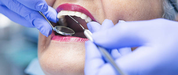 Best Broken or Chipped Tooth Repair in Aspinwall, PA